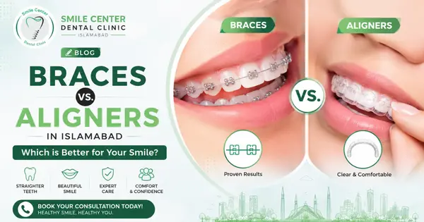 Braces and clear aligners comparison for teeth straightening