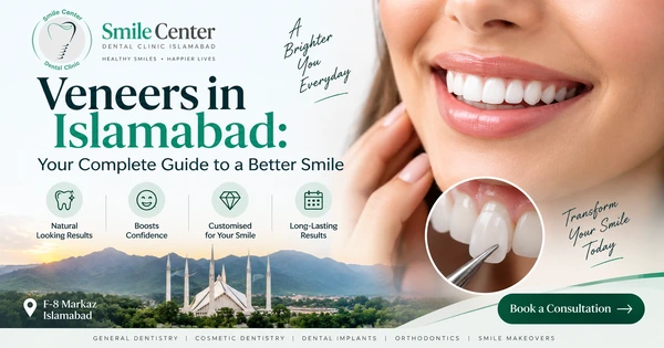 Veneers in Islamabad cosmetic smile treatment guide