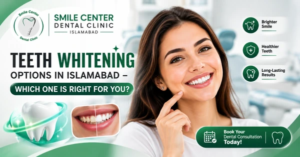 Teeth whitening options for a brighter smile in Islamabad