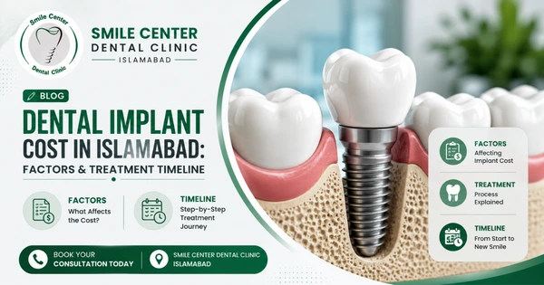 Dental implant cost and treatment timeline in Islamabad