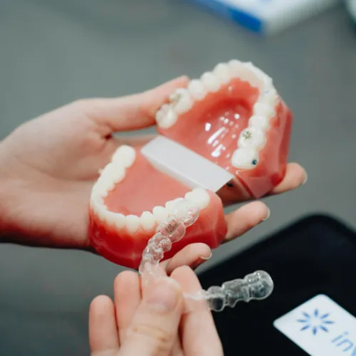 Clear aligner fitting and treatment planning at Smile Center Islamabad