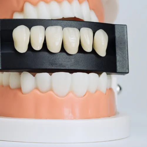 Tooth-colored dental filling materials at Smile Center Islamabad