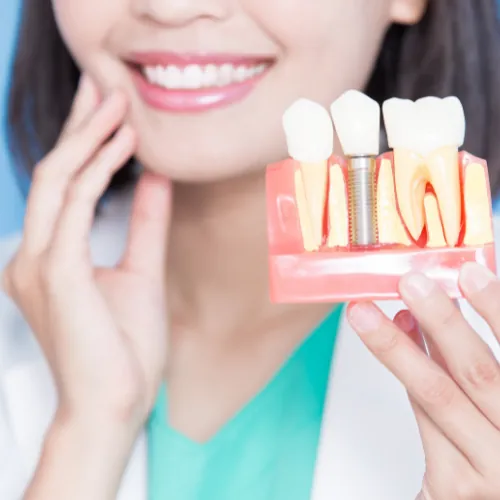 Dental implant treatment explanation at Smile Center Islamabad