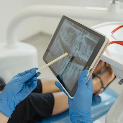 3D dental implant planning and X-ray assessment at Smile Center Islamabad