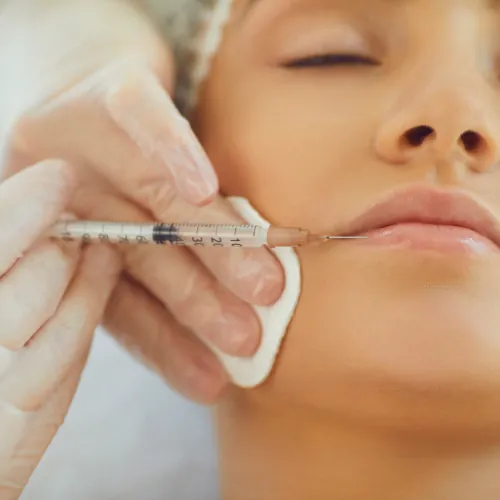 Professional lip filler injection treatment in Islamabad