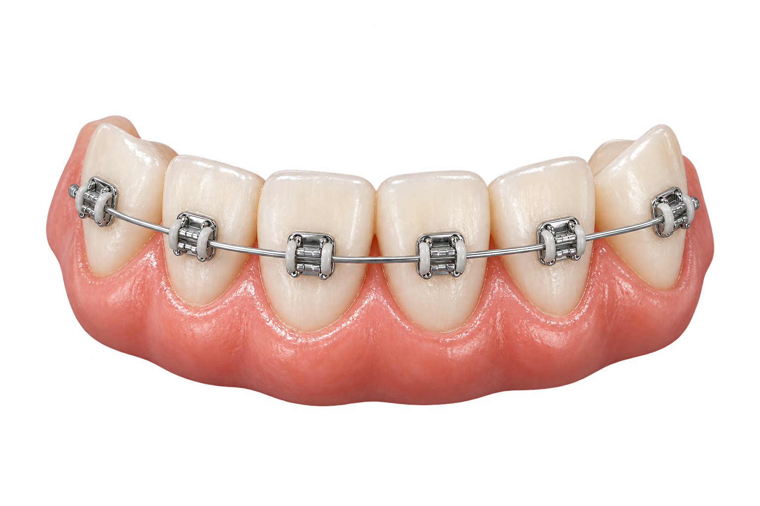 Orthodontics