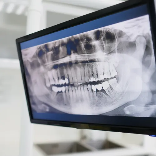 Orthodontic consultation and dental X-ray for teeth alignment in Islamabad
