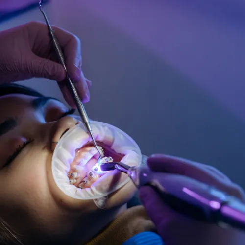 Orthodontic treatment and braces adjustment in Islamabad