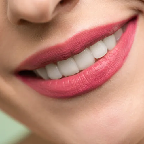 Close-up of bright white teeth after cosmetic whitening treatment