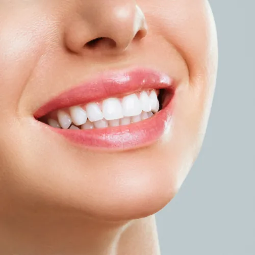 Bright healthy smile after professional teeth whitening