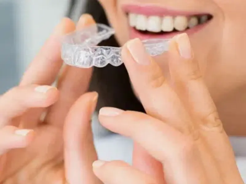 Aligners in Islamabad Smile Center Islamabad 1