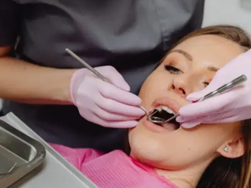 Dental Fillings Smile Center Islamabad 1
